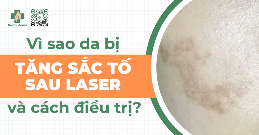 tăng sắc tố sau laser