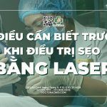 8 điều cần biết trước khi điều trị sẹo bằng laser