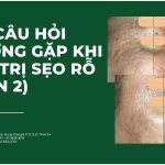 Các câu hỏi thường gặp khi điều trị sẹo rỗ (phần 2)