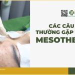 Các câu hỏi thường gặp khi tiêm mesotherapy (phần 1)