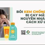 Bôi kem chống nắng bị cay mắt: nguyên nhân và cách xử lý
