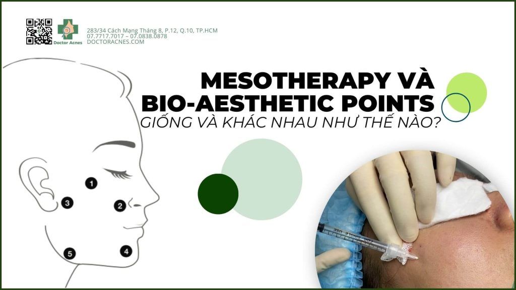 Mesotherapy và Bio-Aesthetic Points (tiêm BAP) giống và khác nhau như thế nào