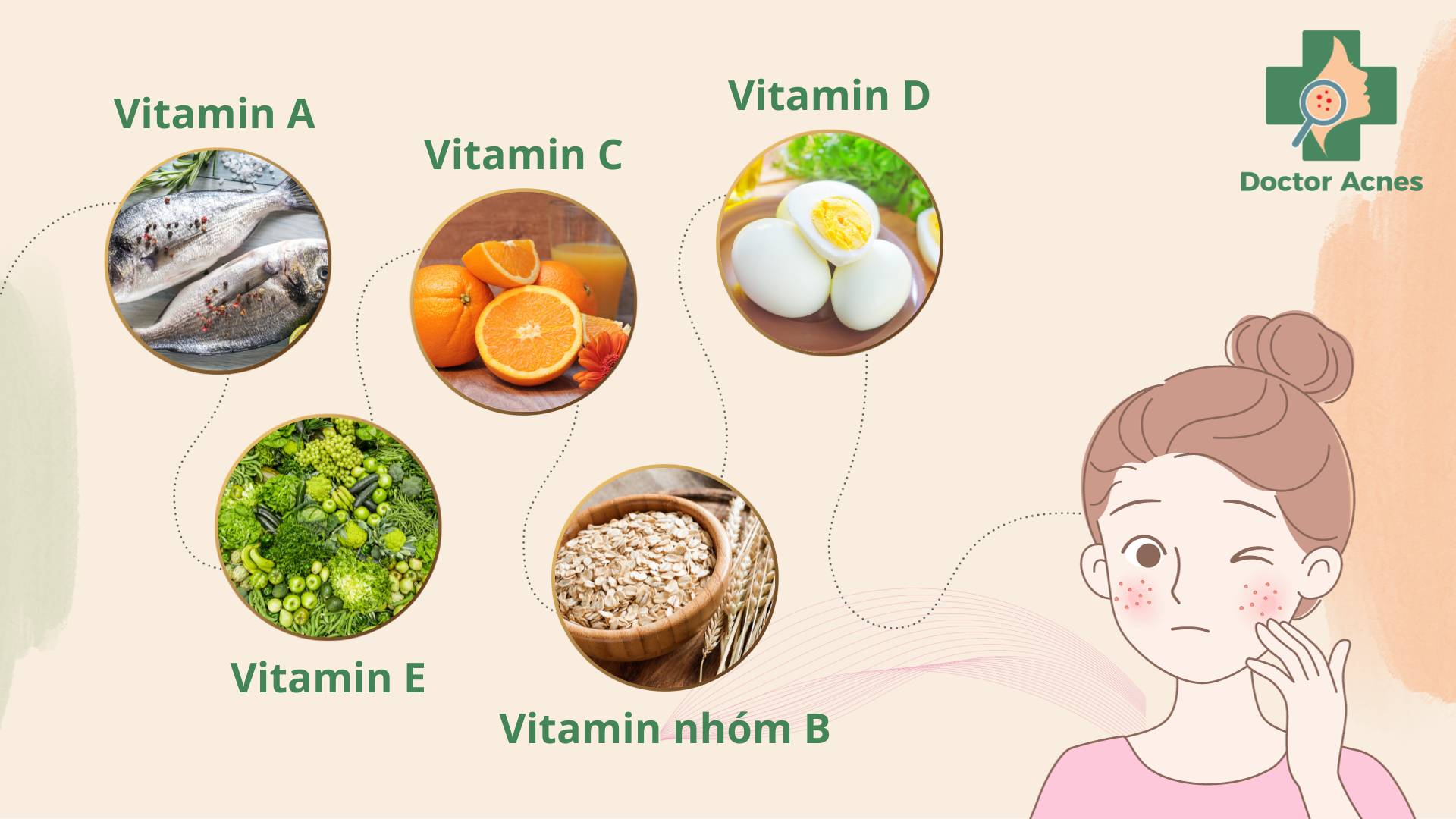 Các vitamin quan trọng cho bệnh nhân mụn gồm A, C, D, E và các vitamin nhóm B