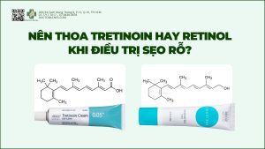 Nên thoa tretinoin hay retinol khi điều trị sẹo rỗ