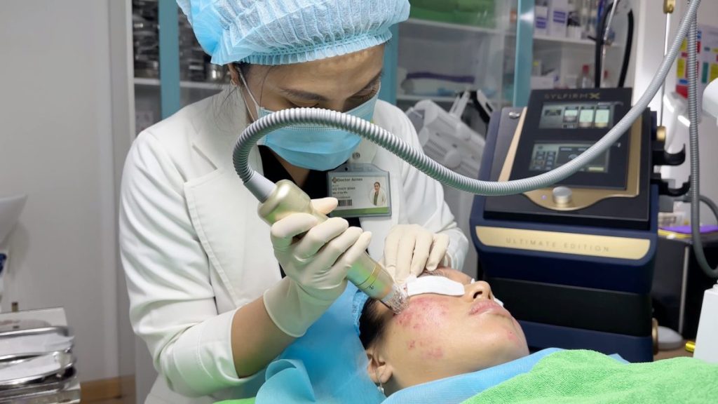 Rf Microneedle therapy at Doctor Acnes