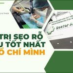 Điều trị sẹo rỗ ở đâu tốt nhất TP. HCM? Top 4+ nơi điều trị tốt nhất