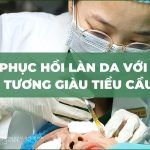 Phục hồi da tổn thương với huyết tương giàu tiểu cầu (PRP)