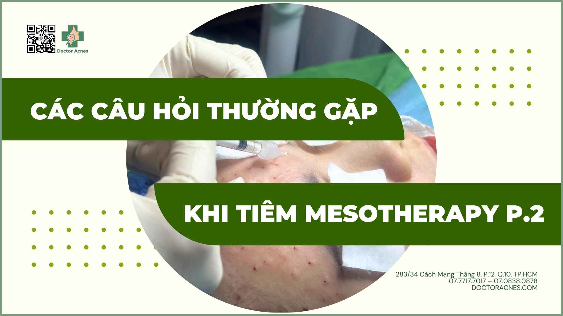 Các câu hỏi thường gặp khi tiêm mesotherapy (phần 2)