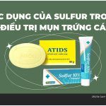 Tác dụng của sulfur (lưu huỳnh) trong điều trị mụn trứng cá