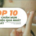 Top 10 thuốc chấm mụn viêm hiệu quả nhất hiện nay