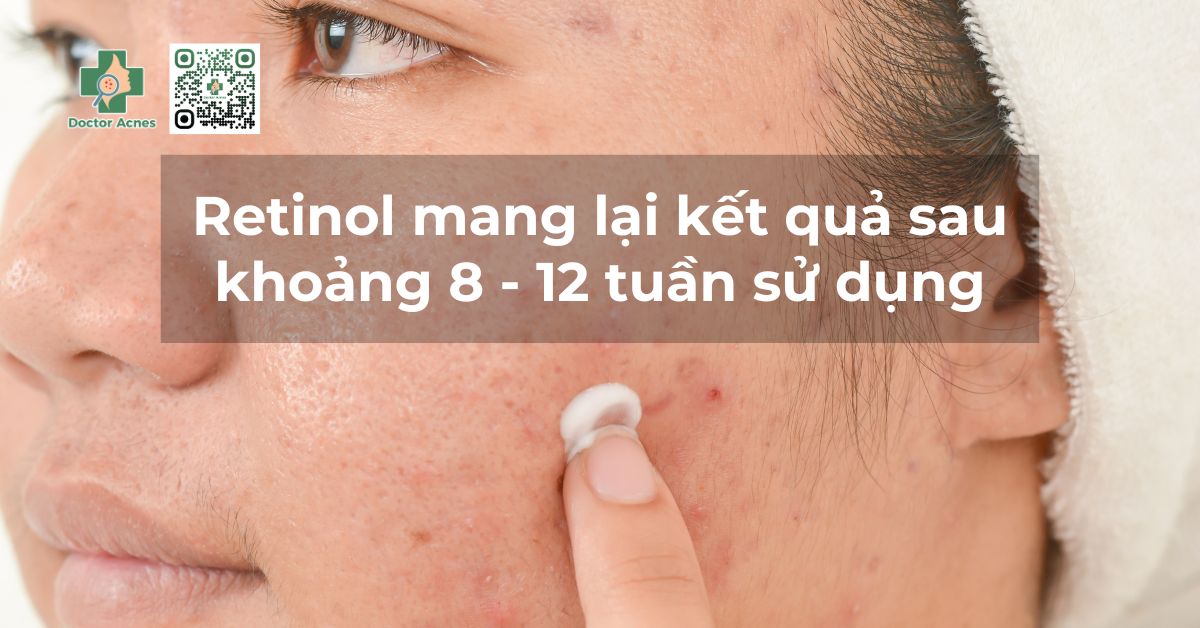 retinol sử dụng bao lâu hiệu quả