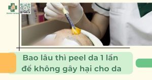 Bao lâu thì peel da 1 lần để không gây hại cho da