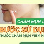Chấm mụn là gì? 3 bước sử dụng thuốc chấm mụn viêm hiệu quả