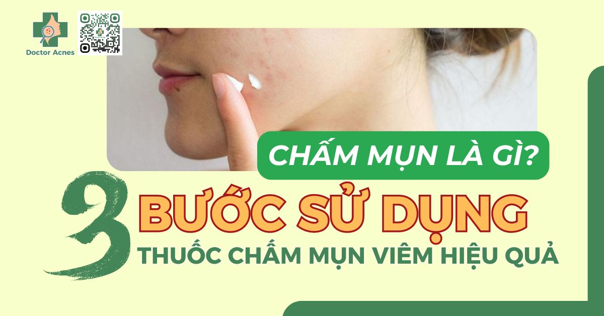 Chấm Mụn Là Gì? Tìm Hiểu Toàn Diện Về Phương Pháp Điều Trị Mụn Hiệu Quả