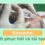 Exosome – Bí quyết phục hồi và tái tạo làn da