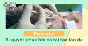 Tế bào gốc exosome