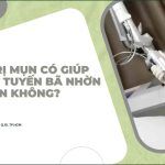 Laser trị mụn có giúp phá hủy tuyến bã nhờn vĩnh viễn không?