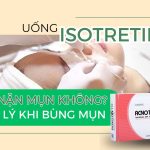 Uống isotretinoin có nên nặn mụn không? Cách xử lý khi bùng mụn!