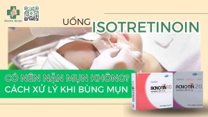 Uống isotretinoin có nên nặn mụn không Cách xử lý khi bùng mụn!