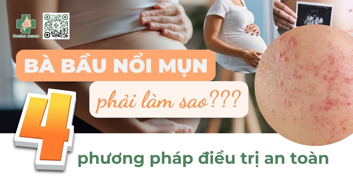 trị mụn cho mẹ bầu