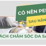 Có nên peel da sau khi nặn mụn? Cách chăm sóc da sau peel