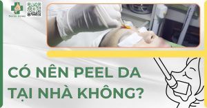 có nên peel da tại nhà không