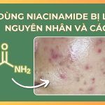 Dùng niacinamide bị lên mụn: nguyên nhân và cách xử lý