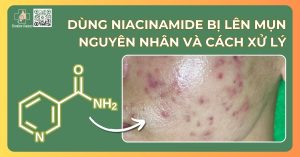 Dùng niacinamide bị lên mụn