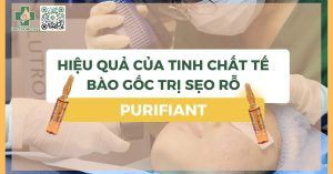 Hiệu quả của tinh chất tế bào gốc trị sẹo rỗ Purifiant