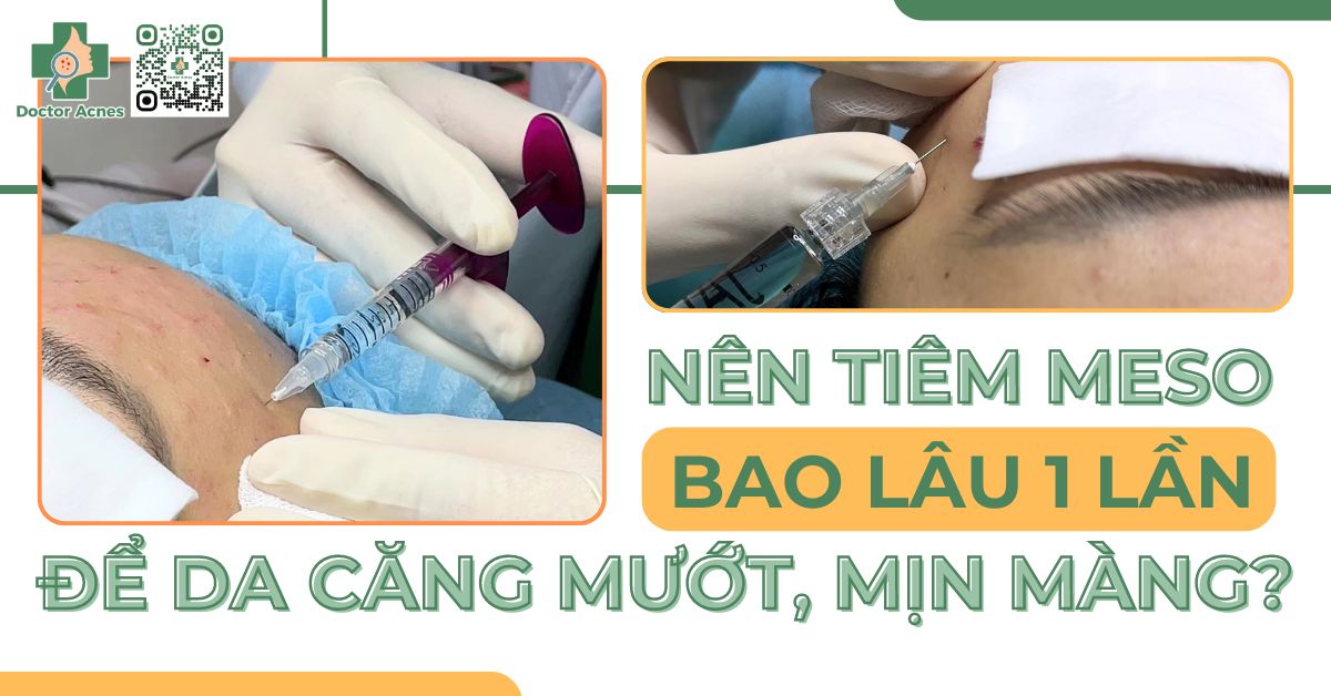 Các tác dụng phụ và rủi ro của tiêm meso