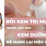 Bôi kem trị mụn trước hay sau kem dưỡng ẩm để mang lại hiệu quả