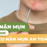 Cách nặn mụn và lựa chọn dụng cụ nặn mụn an toàn