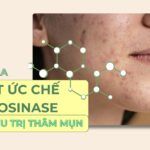Vai trò của chất ức chế tyrosinase trong điều trị thâm mụn