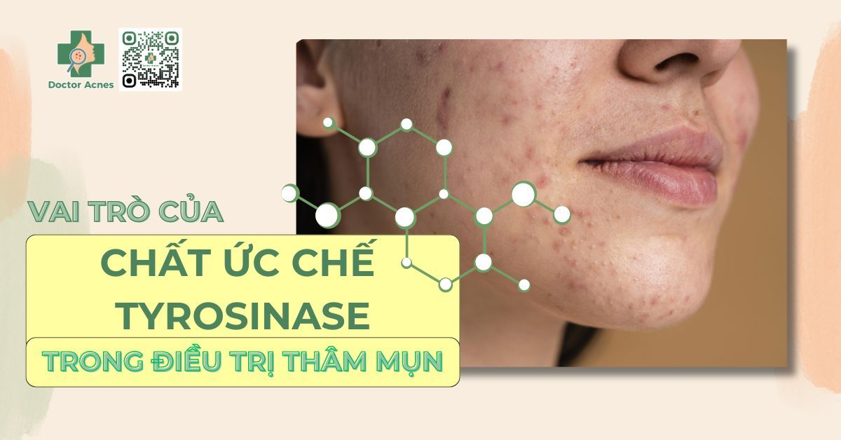 vai trò của chất ức chế tyrosinase trong điều trị thâm mụn