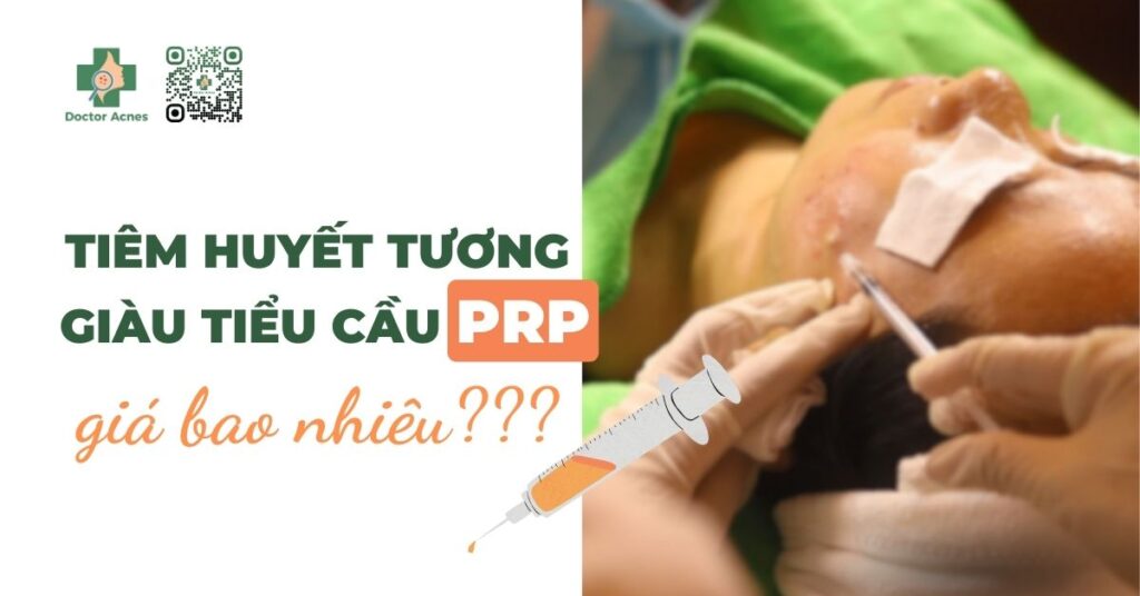 tiêm huyết tương giàu tiểu cầu giá bao nhiêu