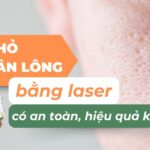Thu nhỏ lỗ chân lông bằng laser có an toàn, hiệu quả không?
