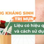 Uống kháng sinh trị mụn liệu có hiệu quả và cách sử dụng