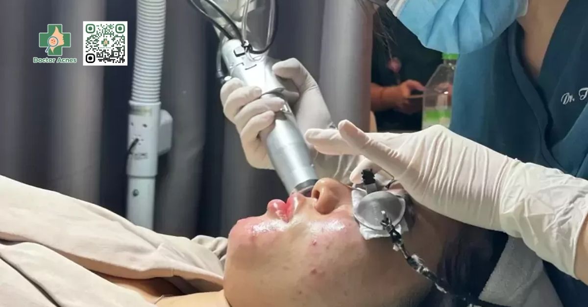 Laser là một loại ánh sáng đặc biệt, không xuất hiện trong tự nhiên, khác với ánh sáng thông thường