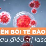Có nên bôi tế bào gốc sau điều trị laser