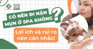 có nên đi nặn mụn ở spa không