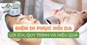 Điện di phục hồi da: lợi ích, quy trình và hiệu quả