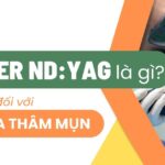 Laser Nd:YAG là gì? Lợi ích đối với làn da thâm mụn