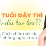 Mụn tuổi dậy thì kéo dài bao lâu? Cách chăm sóc da phòng ngừa mụn