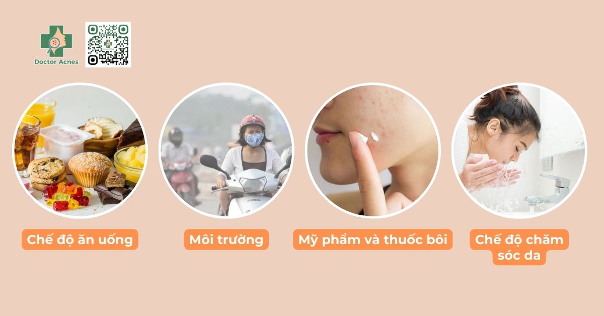 phát sinh mụn