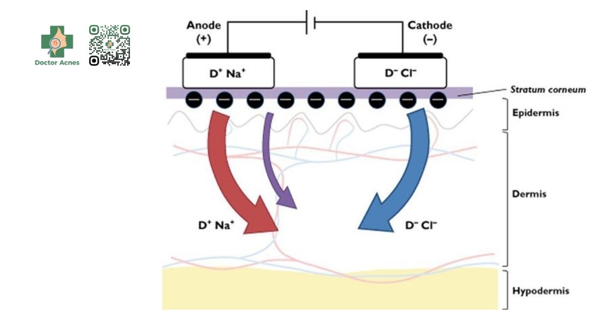 quá trình điện di-iontophoresis