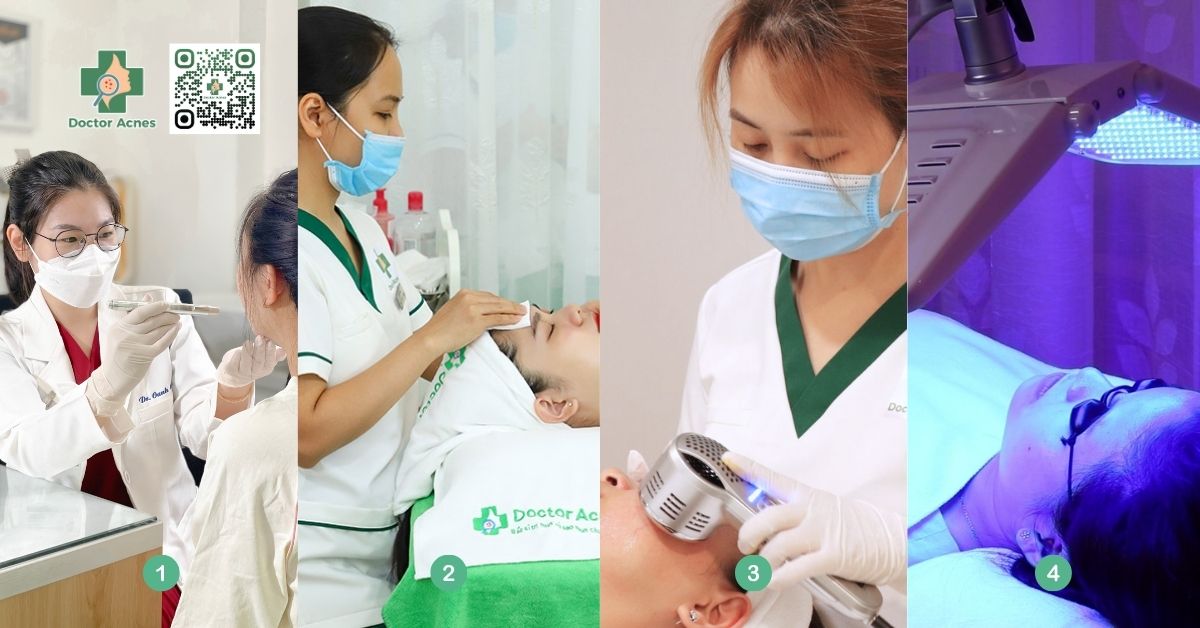 quy trình điện di phục hồi da tại doctor acnes