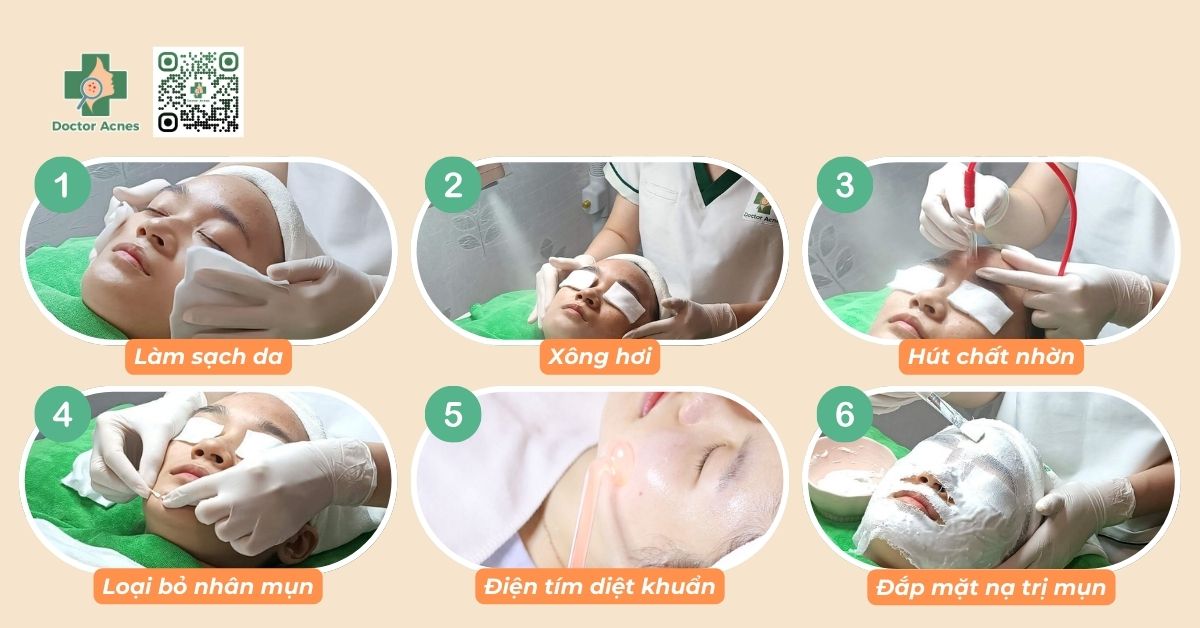 quy trình lấy nhân mụn tại doctor acnes