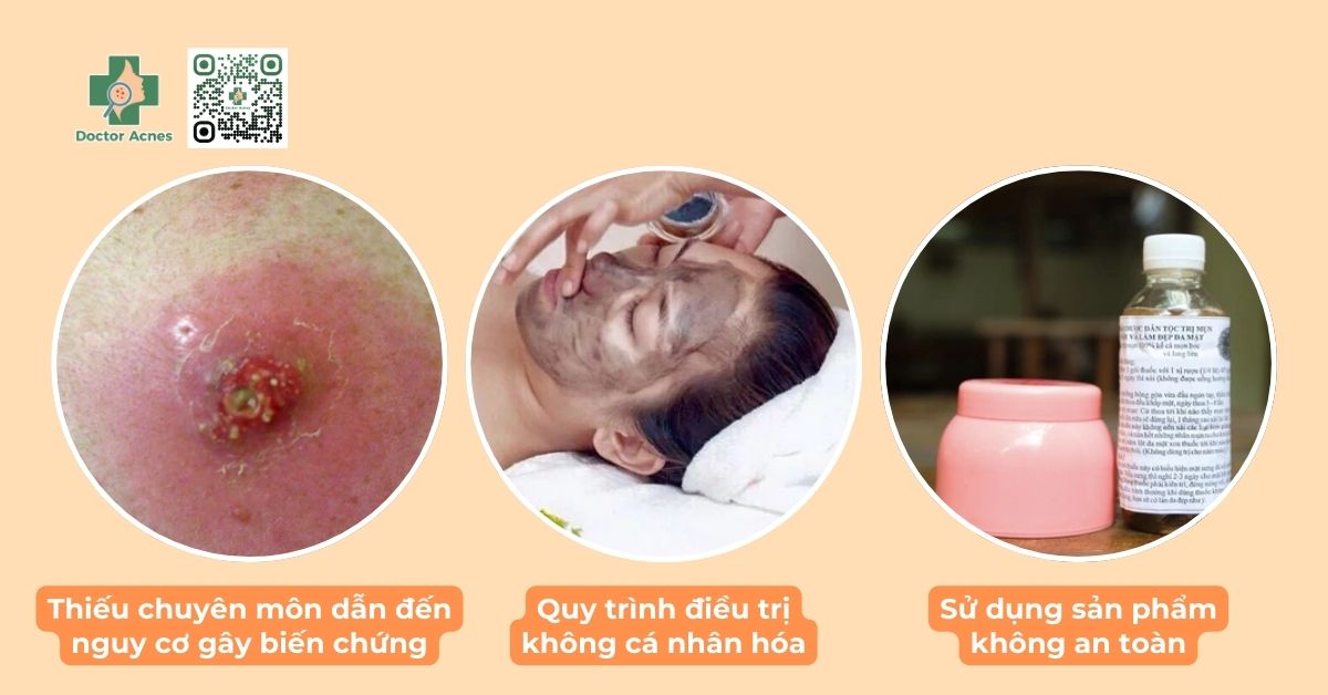 tuổi dậy thì có nên đi spa nặn mụn