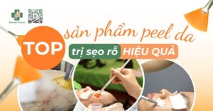 sản phẩm peel da trị sẹo rỗ