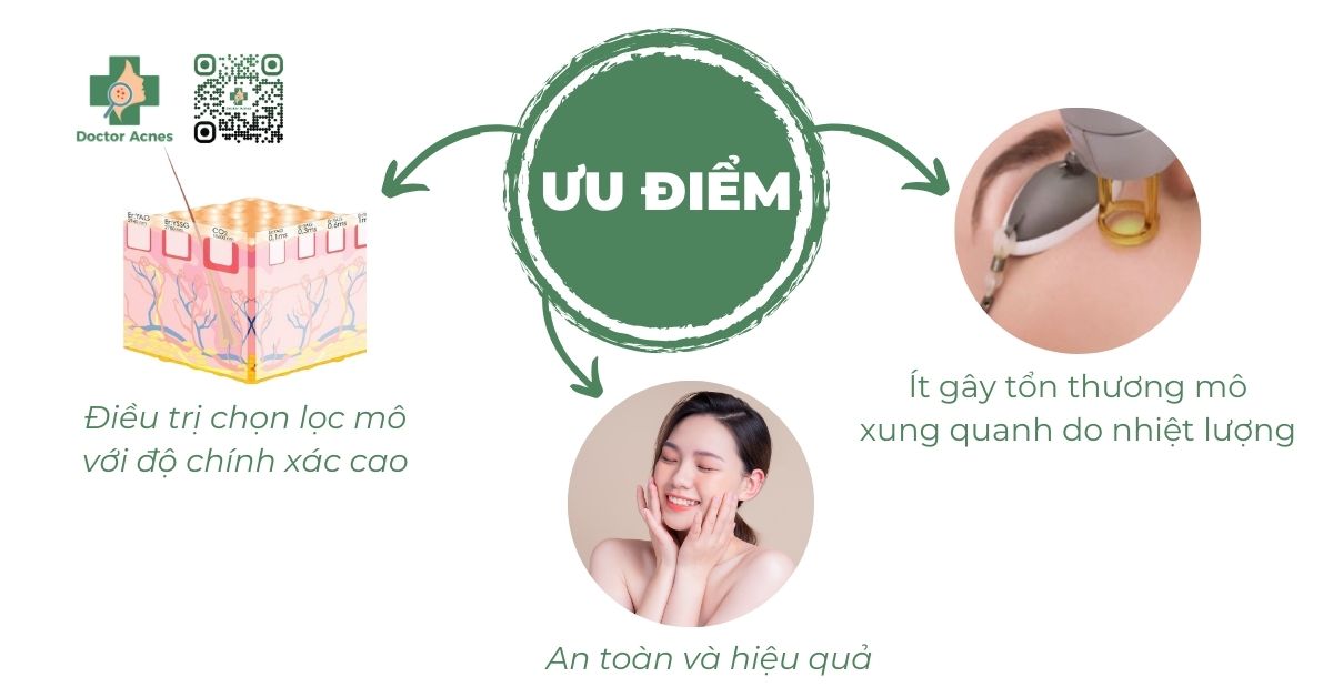 Ưu điểm